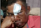 Rusdinur SH MH Minta Pihak Polsek Bukit Raya Tangkap Pelaku Penganiayaan