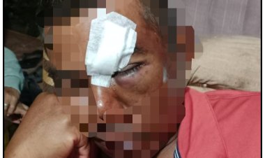 Rusdinur SH MH Minta Pihak Polsek Bukit Raya Tangkap Pelaku Penganiayaan